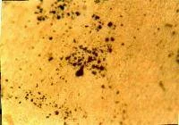 A microscopic photograph shows dark and uniformly granular objects on a light brown background.
