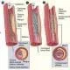 cub_biomed_lesson03_activity1.jpg