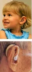 Two photos show a young girl and an older man, each wearing behind-the-ear hearing aids.