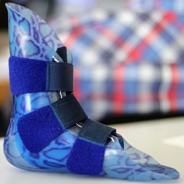 Prosthetic Leg Design Challenge