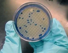 Picture of colonies of fecal coliform bacteria filtered from water samples and grown on mFC nutrient agar. The sample indicates fecal contamination of the water.