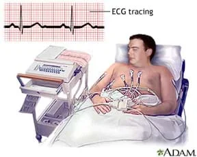 A drawing shows a man reclining in a bed with electrodes on his bare chest connected to a device near the bed. A line drawing shows the familiar blips of an electrocardiogram (heartbeat)—an ECG tracing.