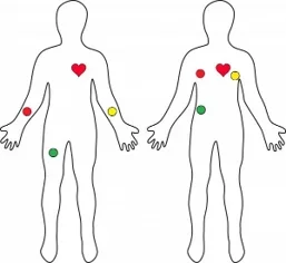 A figure showing outlines of human bodies with marked locations for typical sensor placements.