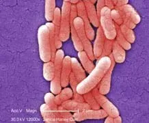 Microscopic photograph looks like a mass of oblong pink capsules.