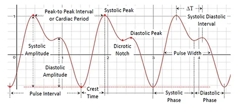 Main parts of a Photoplethysmografic pulse.