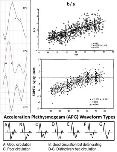 An image identifying PPG, VPG, and APG pulses and the statistical analysis that gave formulas to quantify the arterial stiffness, vascular aging indexes, as well as vascular age.