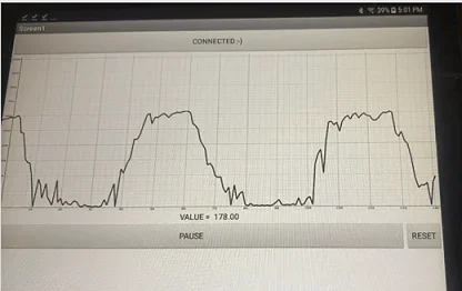An Android tablet running an app that displays uterine contractions graphically. Three contractions of pressure vs time are displayed.