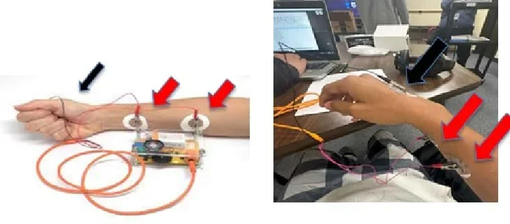 An image of an arm with electromyogram (EMG) skin electrodes placed for collecting muscle data.