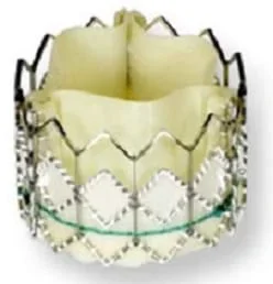 Photo of an example artificial heart valve made of stainless steel mesh and animal tissue.