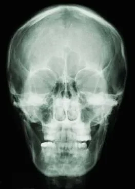 X-ray of a human skull.
